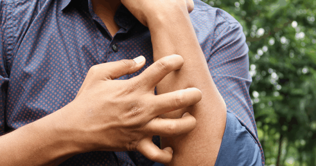 image - California Mental Health Anxious man scratching his arm, possibly seeking Hydroxyzine for anxiety relief, showcasing skin irritation and discomfort.